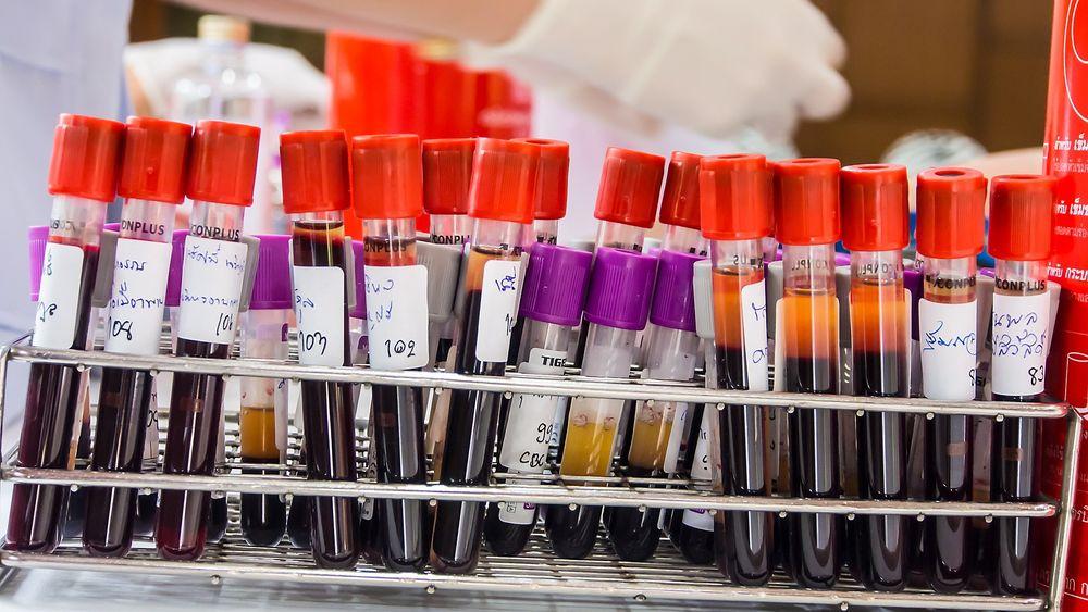 Rett hjem: Det norske firmaet tilbyr kundene å få svar på blodprøvene i posten. 